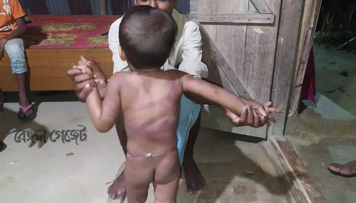 কোলের শিশুকে নির্দয়ভাবে পিটিয়ে মনের ঝাল মেটালেন মা